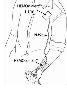 HEMOdialert hemodialysis alarm with HEMOsensor - detect blood leaks